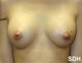 Patient # 78469 After Photo # 2